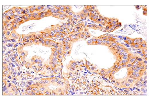 Immunohistochemistry Image 6: G3BP1 (E9G1M) XP<sup>®</sup> Rabbit mAb