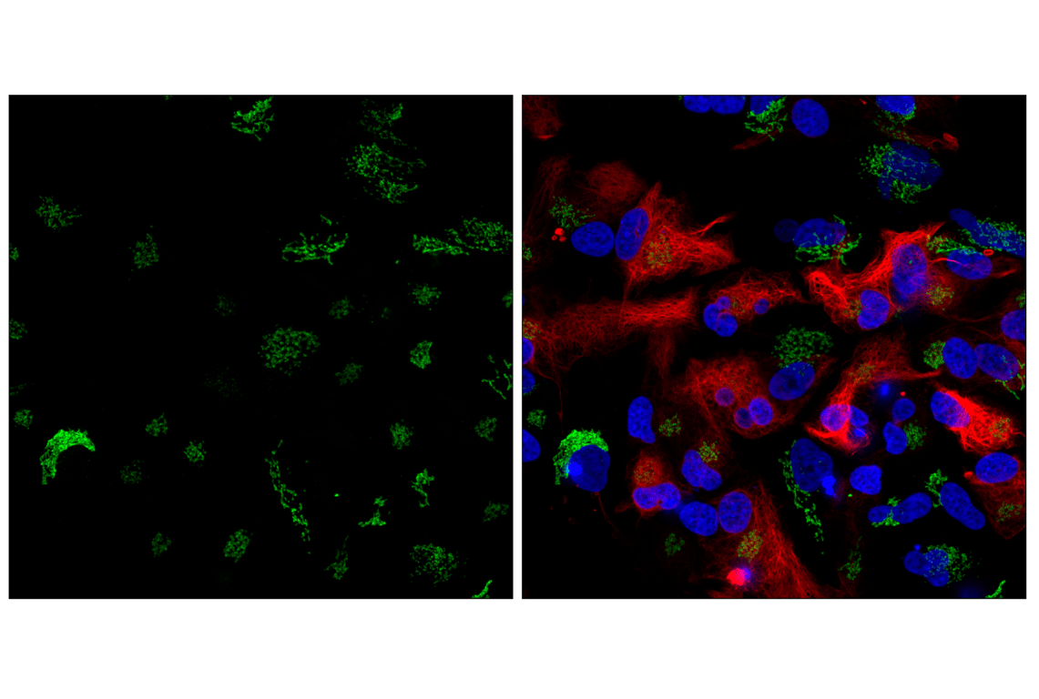 Immunofluorescence Image 3: GM130 (D6B1) XP<sup>®</sup> Rabbit mAb