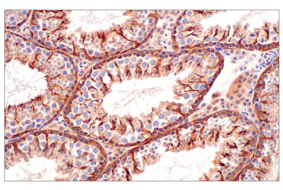 Immunohistochemistry Image 12: MTAP (E5R1I) Rabbit mAb (BSA and Azide Free)
