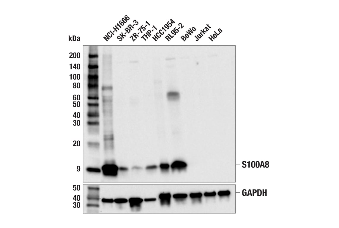 Western Blotting Image 1: S100A8 (F4R2W) Rabbit mAb (BSA and Azide Free)