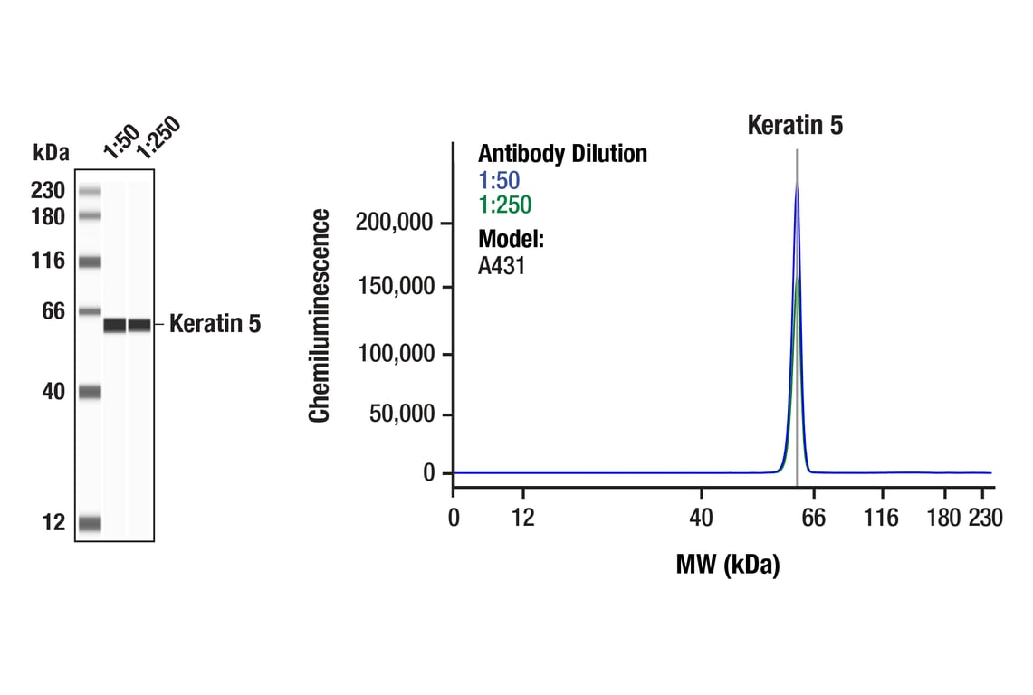 Western Blotting Image 1: Keratin 5 (E2T4B) XP® Rabbit mAb
