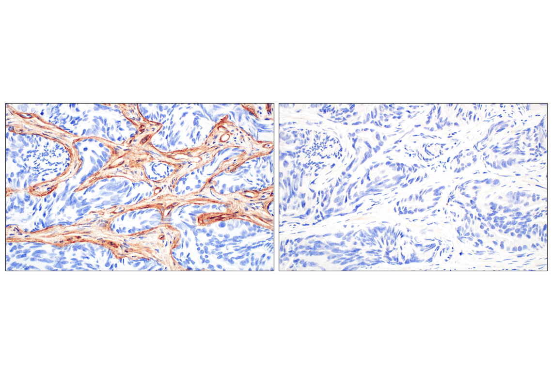 Immunohistochemistry Image 8: COL4A1 (E5M6R) Rabbit mAb (IHC Formulated)