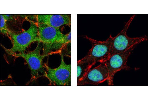Immunofluorescence Image 1: FoxO3a (75D8) Rabbit mAb