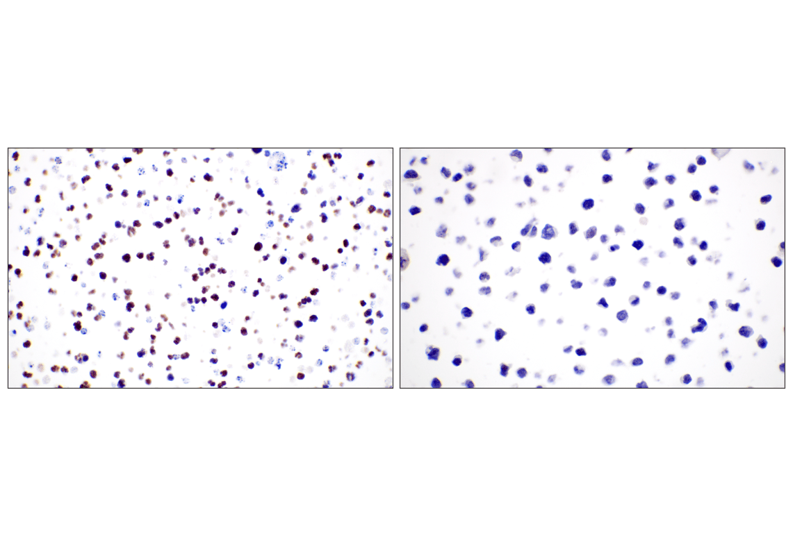 Immunohistochemistry Image 10: TCF4/ITF2 (E3X2Y) Rabbit mAb