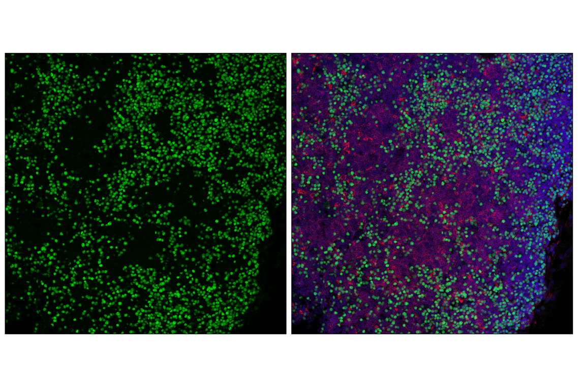 Immunofluorescence Image 3: Phospho-Rb (Ser807/811) (D20B12) XP<sup>®</sup> Rabbit mAb