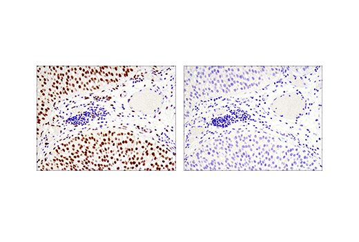 Immunohistochemistry Image 2: Phospho-ATF-2 (Thr71)/ATF-7 (Thr53) (E4A5G) XP<sup>®</sup> Rabbit mAb