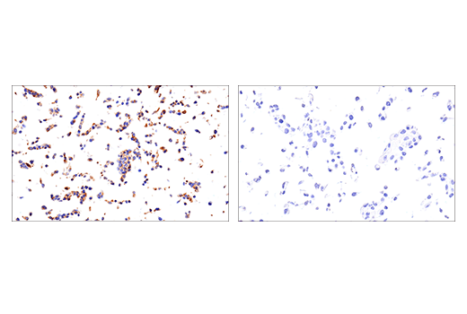 undefined Image 32: Extracellular Matrix Dynamics Antibody Sampler Kit