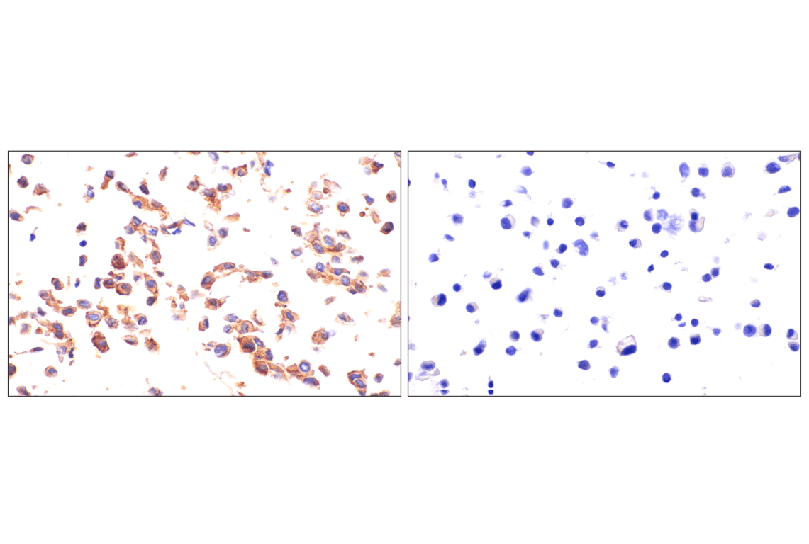 Immunohistochemistry Image 8: Axl (E3Z2H) Rabbit mAb