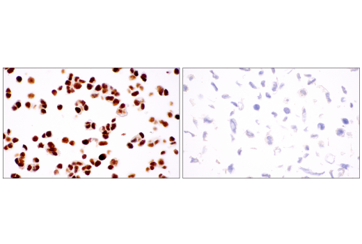 Immunohistochemistry Image 7: ATRX (E5X7O) Rabbit mAb