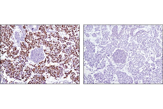 Immunohistochemistry Image 2: MCM4 (D3H6N) XP<sup>®</sup> Rabbit mAb (BSA and Azide Free)