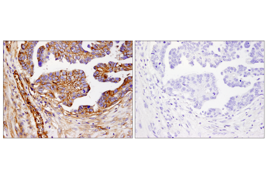 Immunohistochemistry Image 3: B7-H3 (D9M2L) XP<sup>®</sup> Rabbit mAb (BSA and Azide Free)