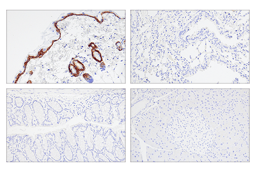 Immunohistochemistry Image 3: Keratin 5 (E2T4B) XP<sup>®</sup> Rabbit mAb
