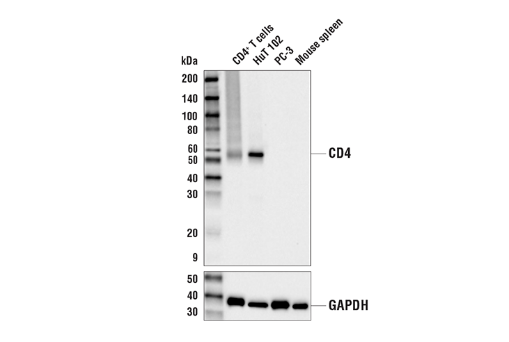 Western Blotting Image 1: CD4 (D2E6M) Rabbit mAb