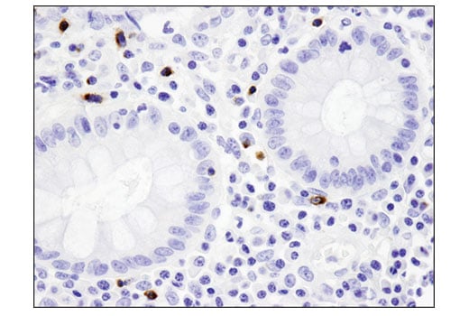 undefined Image 34: Human Exhausted CD8<sup>+</sup> T Cell IHC Antibody Sampler Kit