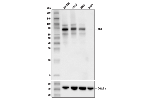Western Blotting Image 1: p63 (D9L7L) XP® Rabbit mAb
