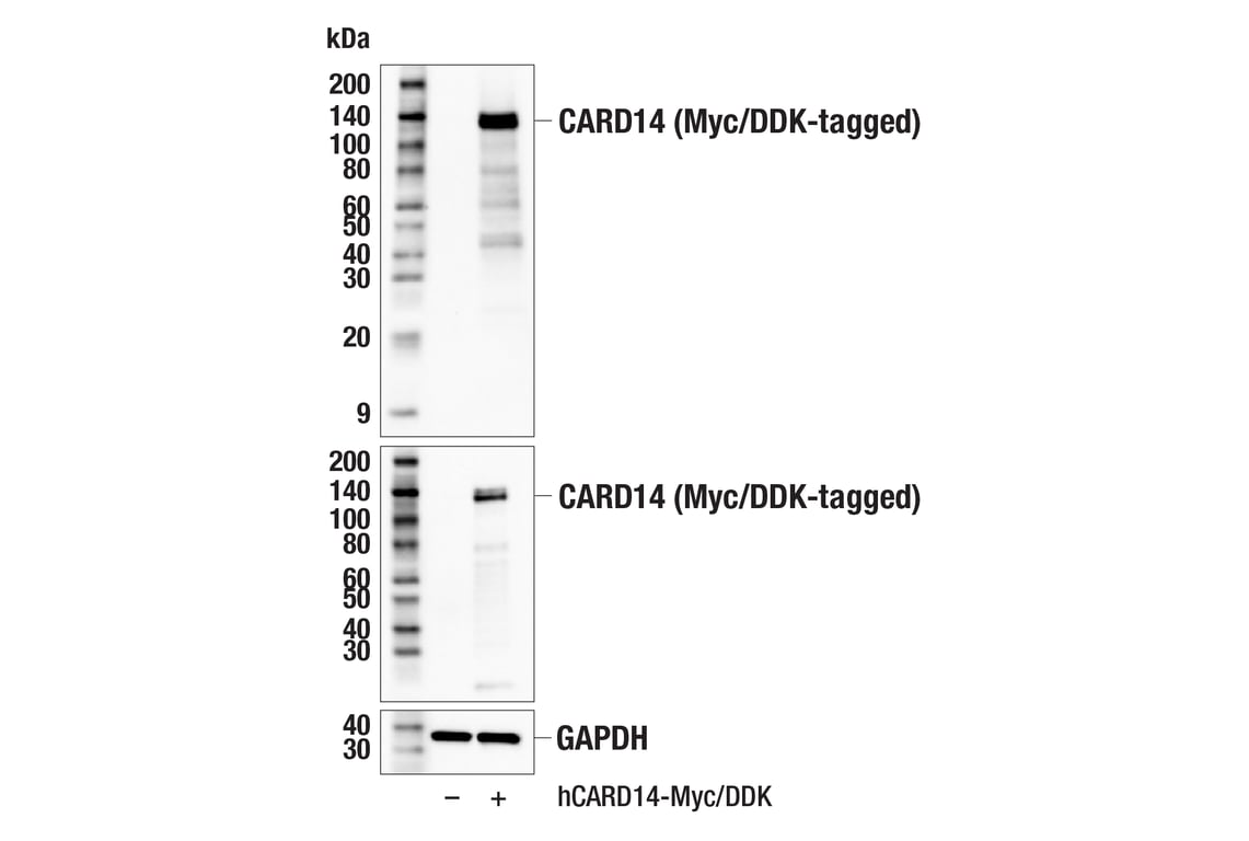 Western Blotting Image 2: CARD14 (E3F8E) Rabbit mAb