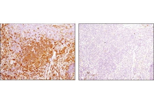 Immunohistochemistry Image 2: Syk (D3Z1E) XP<sup>®</sup> Rabbit mAb (BSA and Azide Free)