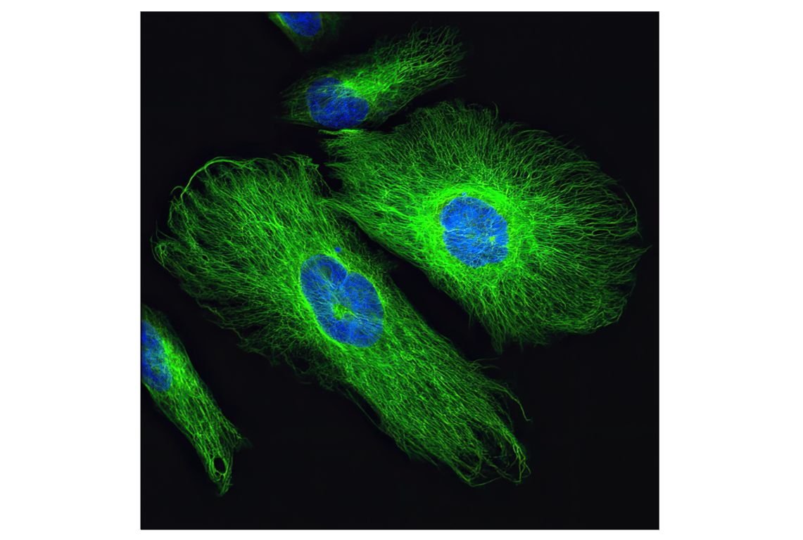 Immunofluorescence Image 1: Vimentin (D21H3) XP<sup>®</sup> Rabbit mAb (BSA and Azide Free)