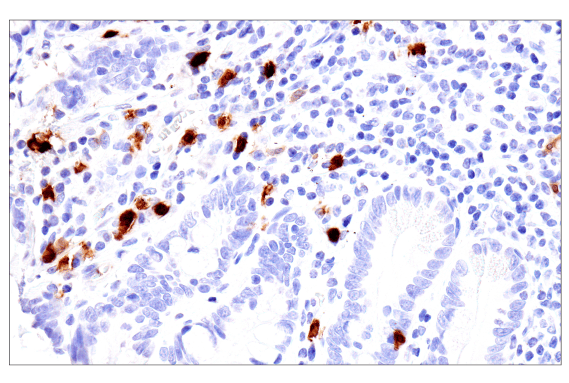 Immunohistochemistry Image 9: S100A8 (F4R2W) Rabbit mAb (BSA and Azide Free)