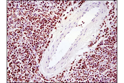 Immunohistochemistry Image 3: Ezh2 (D2C9) XP<sup>®</sup> Rabbit mAb (BSA and Azide Free)