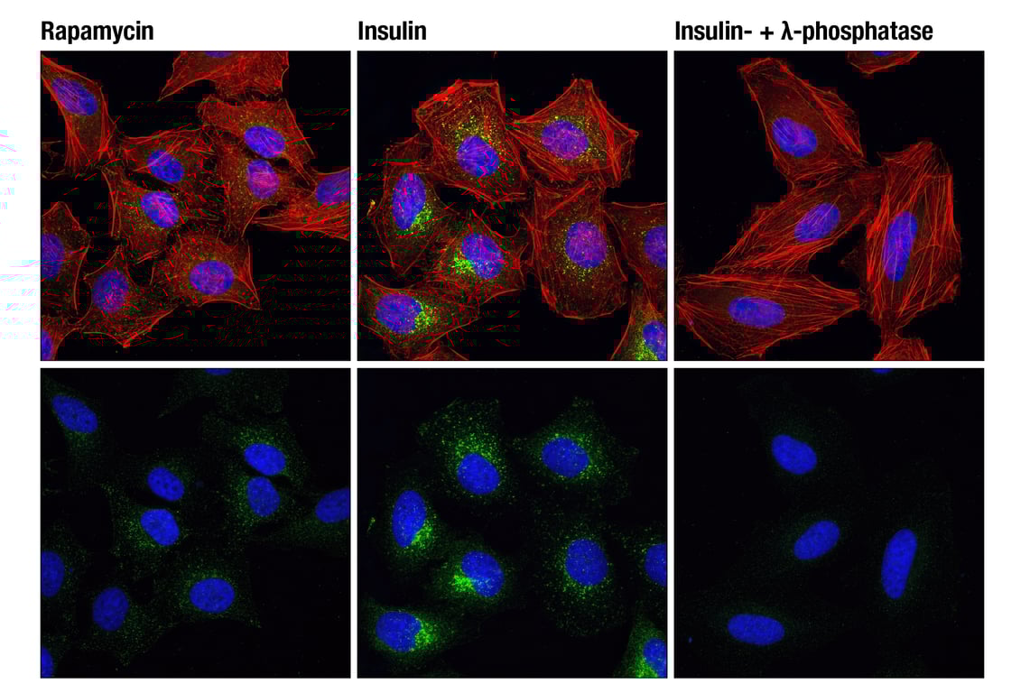 undefined Image 24: TREM2-dependent mTOR Metabolic Fitness Antibody Sampler Kit