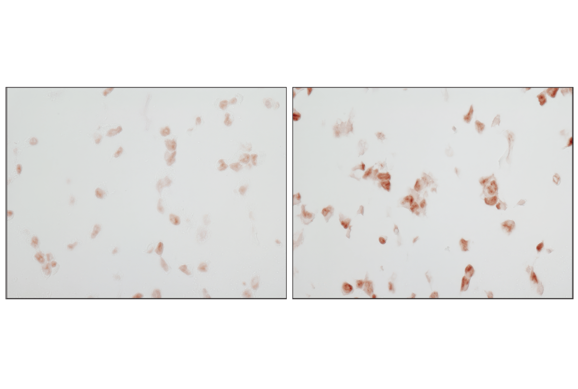 undefined Image 32: Angiogenesis Antibody Sampler Kit