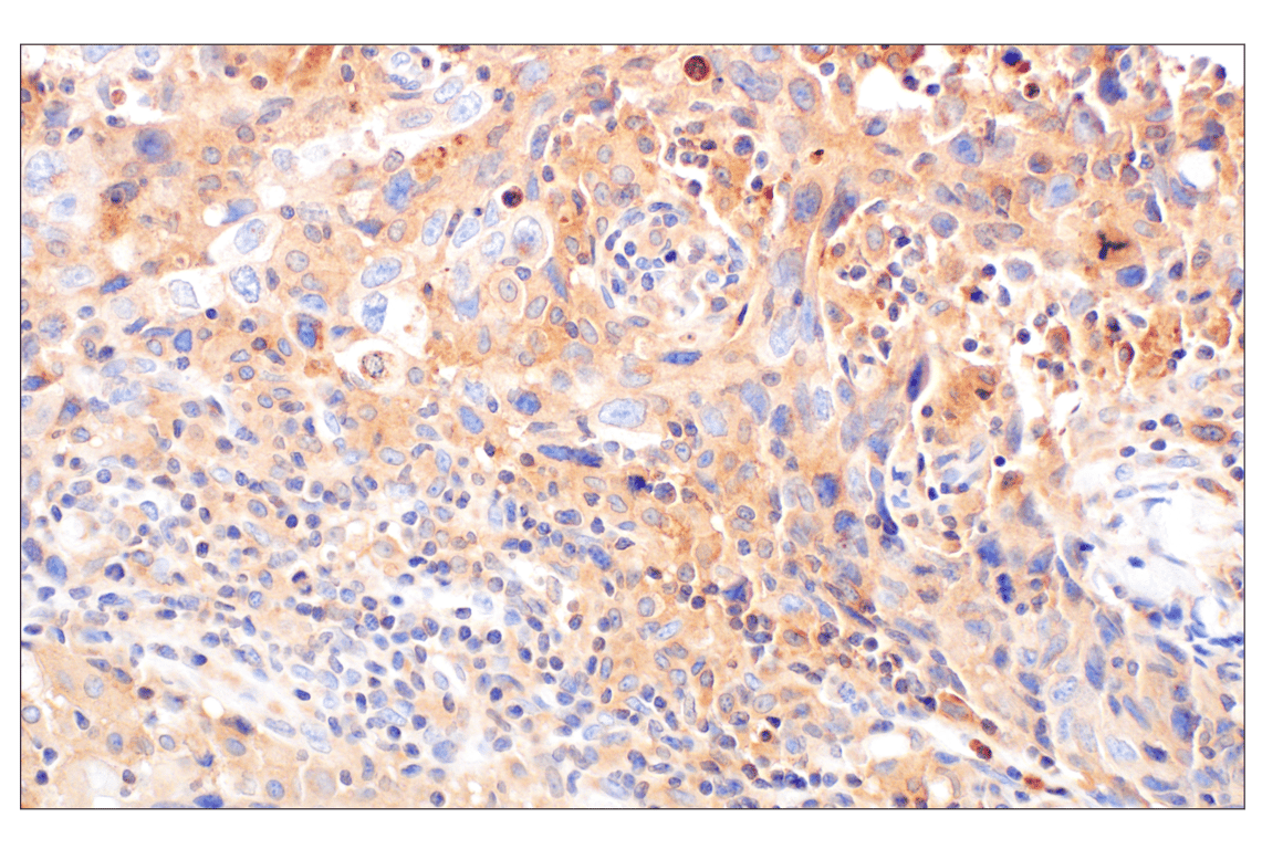 undefined Image 5: Rho-GTPase Antibody Sampler Kit