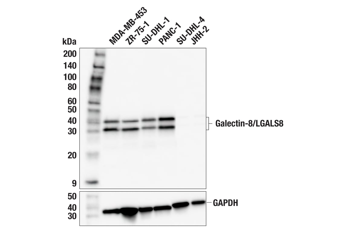 Western Blotting Image 1: Galectin-8/LGALS8 (F9O3T) Rabbit mAb