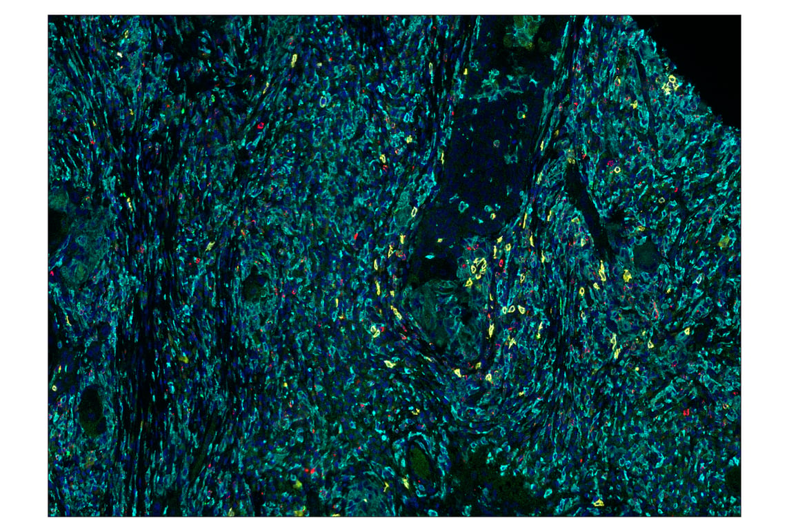 Immunohistochemistry Image 1: CD20 (E7B7T) & CO-0011-750 SignalStar<sup>™</sup> Oligo-Antibody Pair