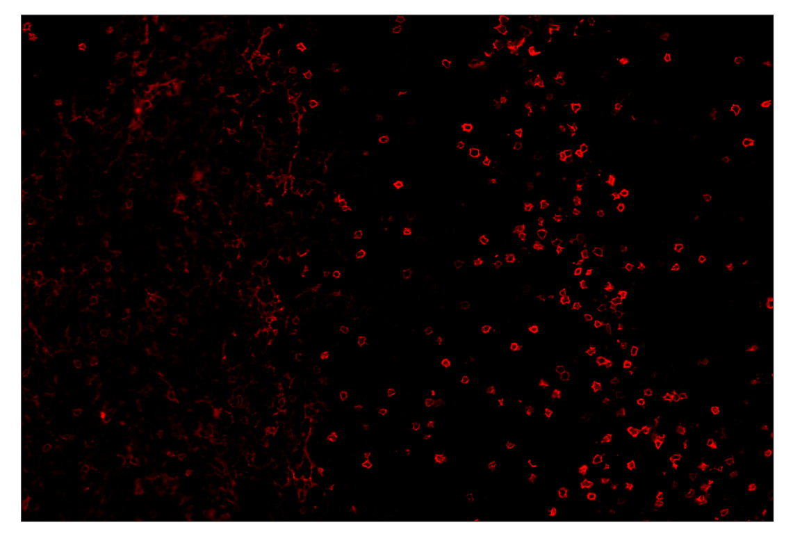 Immunohistochemistry Image 4: IL-2Rα/CD25 (E9W2J) & CO-0074-594 SignalStar<sup>™</sup> Oligo-Antibody Pair