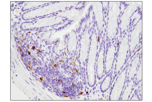 Immunohistochemistry Image 3: PD-1 (Intracellular Domain) (D7D5W) XP<sup>®</sup> Rabbit mAb