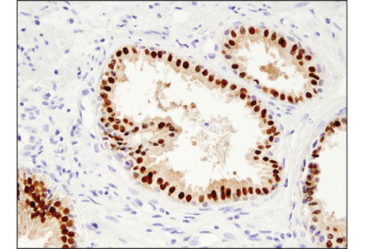 Immunohistochemistry Image 1: NKX3.1 (D6D2Z) XP<sup>®</sup> Rabbit mAb