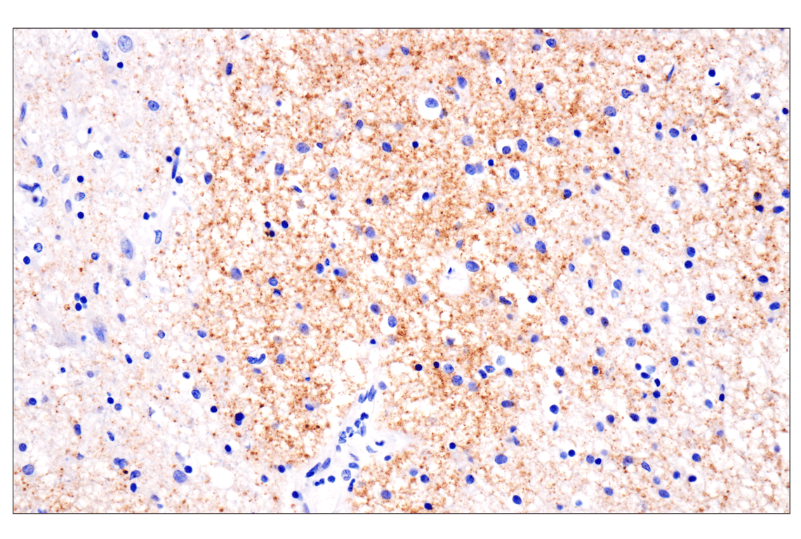 Immunohistochemistry Image 1: VGLUT2 (F1T6V) Rabbit mAb