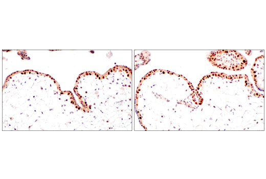 Immunohistochemistry Image 1: DNMT1 (D63A6) XP<sup>®</sup> Rabbit mAb (BSA and Azide Free)