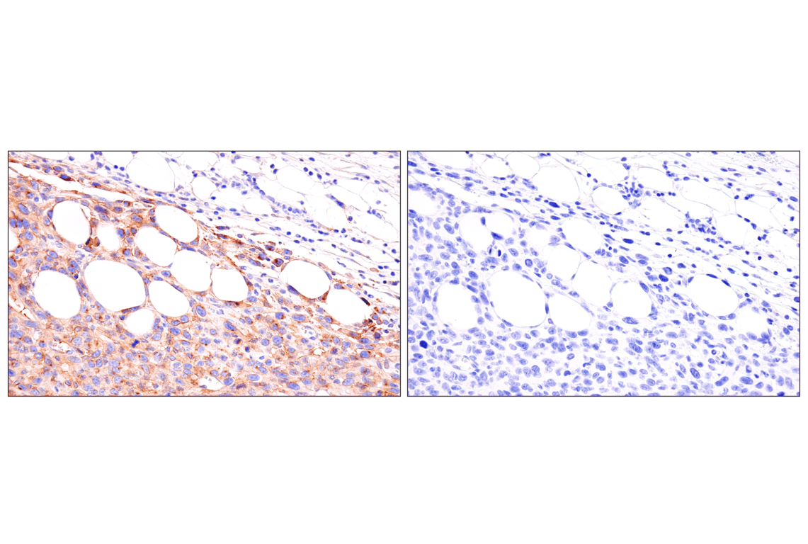 Immunohistochemistry Image 7: Axl (E3Z2H) Rabbit mAb