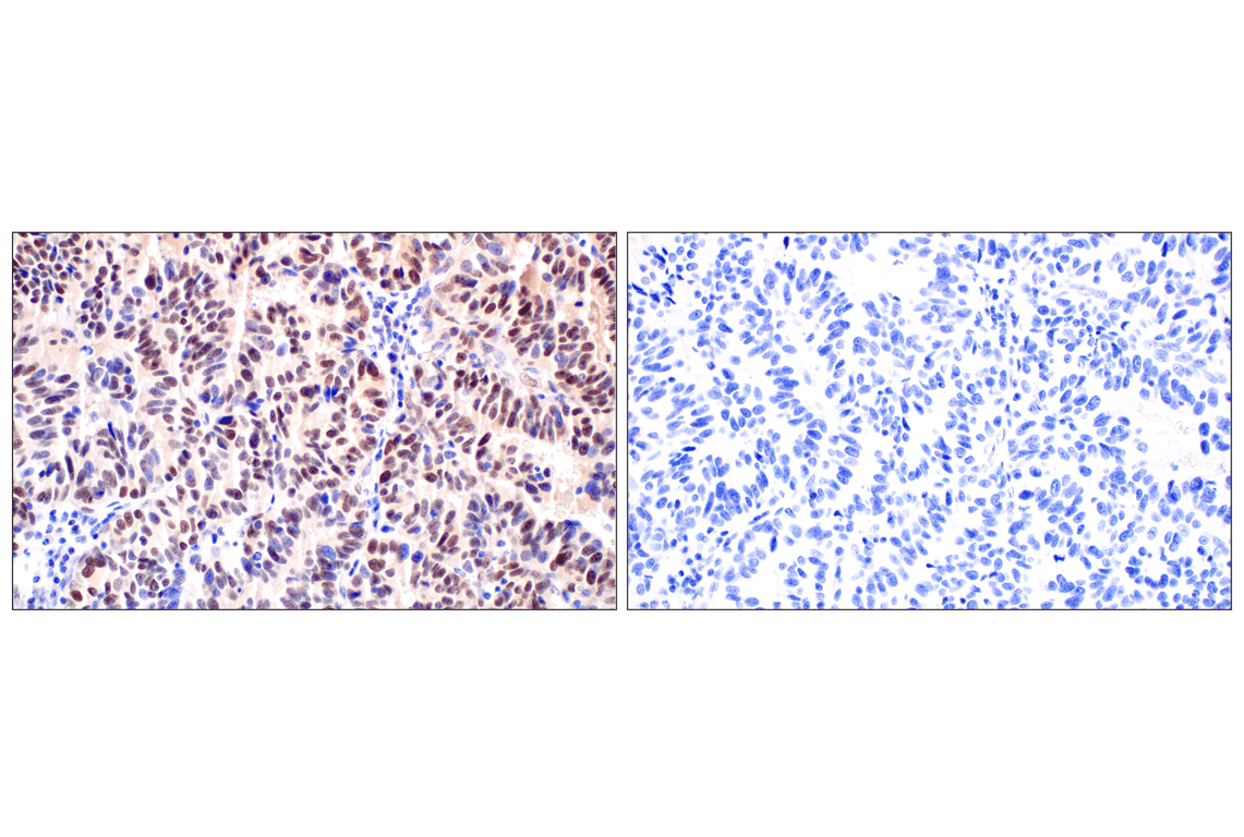 Immunohistochemistry Image 8: ID1 (F2M1J) Rabbit mAb (BSA and Azide Free)