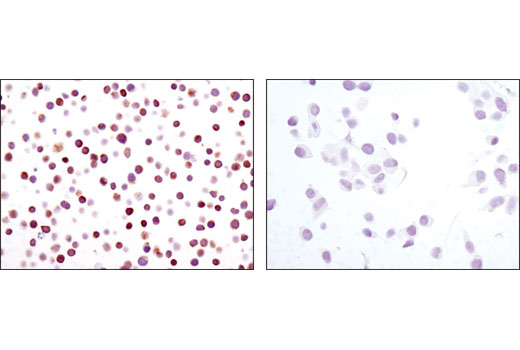 Immunohistochemistry Image 4: NFAT1 (D43B1) XP<sup>®</sup> Rabbit mAb (BSA and Azide Free)