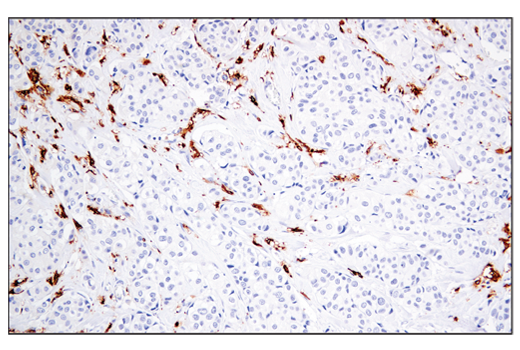 undefined Image 39: Late-Onset Alzheimer's Disease Risk Gene Antibody Sampler Kit