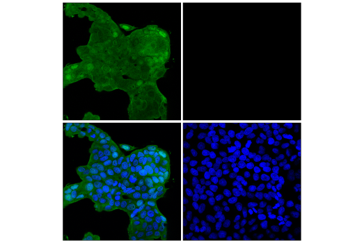 Immunofluorescence Image 1: p70 S6 Kinase (E8K6T) XP<sup>®</sup> Rabbit mAb