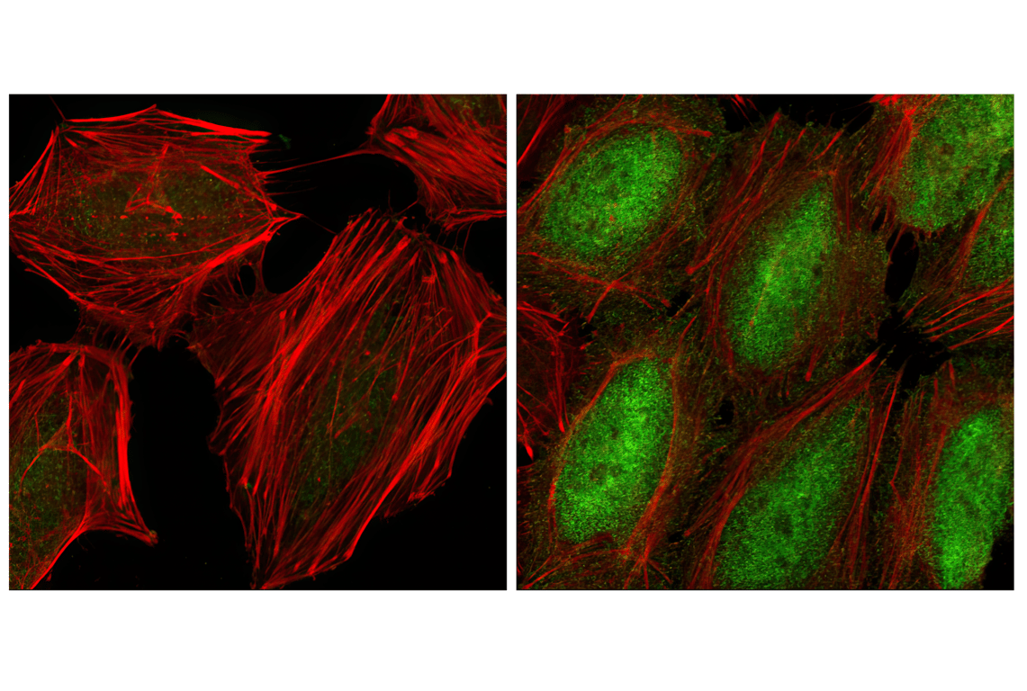 undefined Image 4: PhosphoPlus<sup>®</sup> NF-κB p65/RelA (Ser536) Antibody Duet