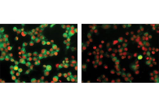 Immunofluorescence Image 1: Phospho-RelB (Ser552) (D41B9) XP<sup>®</sup> Rabbit mAb (BSA and Azide Free)