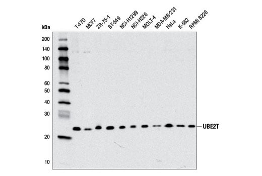 Western Blotting Image 1: UBE2T (D2L7H) Rabbit mAb