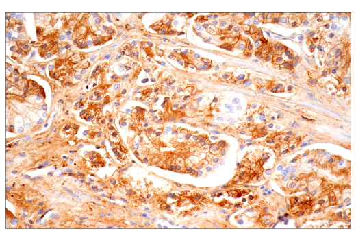 Immunohistochemistry Image 8: α-2-Macroglobulin (E6N7X) Rabbit mAb