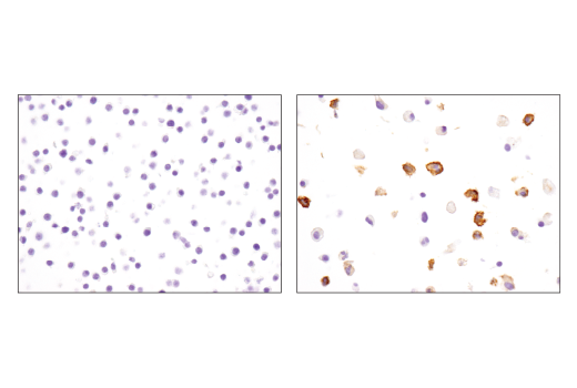 Immunohistochemistry Image 1: PD-L1 (D5V3B) Rabbit mAb