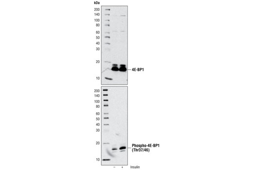 Western Blotting Image 1: Phospho-4E-BP1 (Thr37/46) (236B4) Rabbit mAb (BSA and Azide Free)