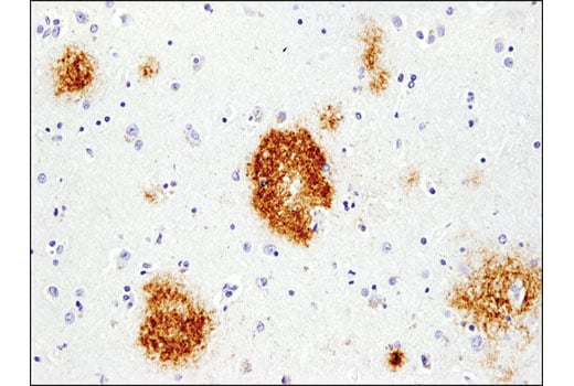 undefined Image 18: β-Amyloid Antibody Sampler Kit