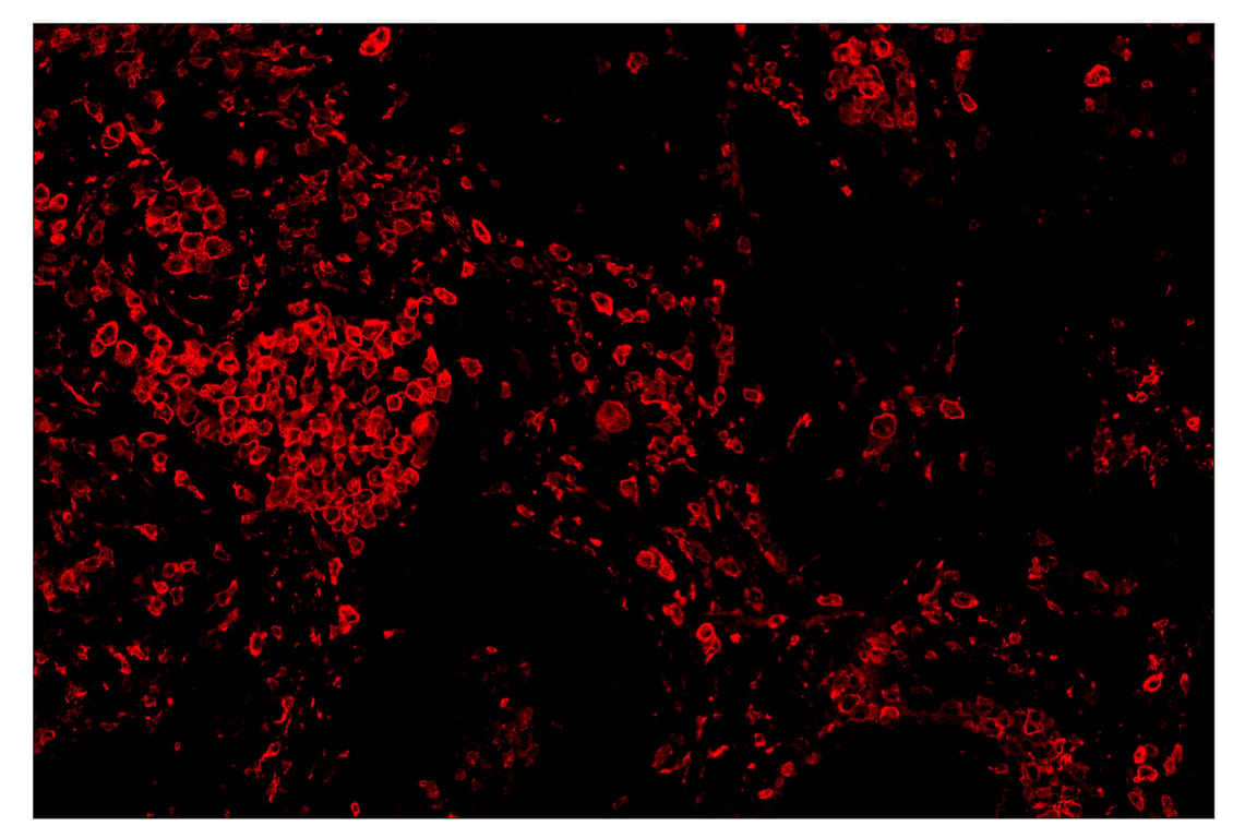 Immunohistochemistry Image 4: CD163 (D6U1J) & CO-0022-647 SignalStar<sup>™</sup> Oligo-Antibody Pair