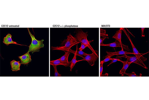 Immunofluorescence Image 1: Phospho-HSP27 (Ser82) (D1H2F6) XP<sup>®</sup> Rabbit mAb (BSA and Azide Free)