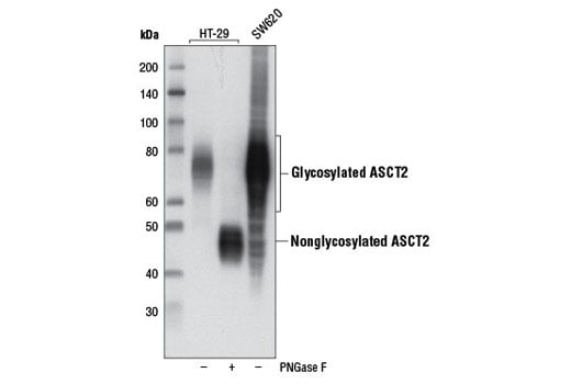 undefined Image 8: Glutamine Metabolism Antibody Sampler Kit