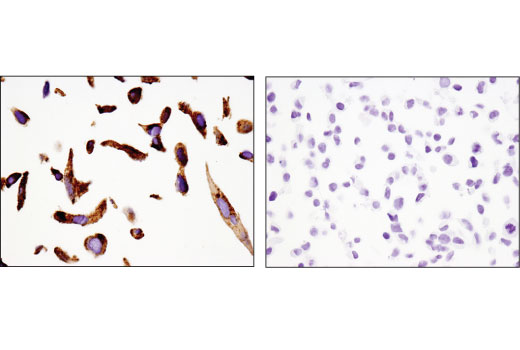 Immunohistochemistry Image 2: Napsin A (D5P6G) XP<sup>®</sup> Rabbit mAb